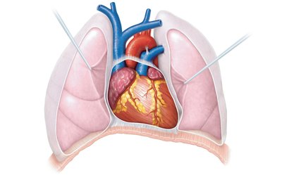 Heart in thoracic cavity, showing lungs, diaphragm, and heart orientation