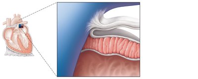 Detailed view of pericardial layers and heart wall