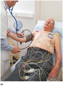 Patient with ECG electrodes