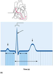 ECG tracing with labeled waves and intervals