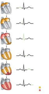 Depolarization and repolarization sequence correlated to ECG