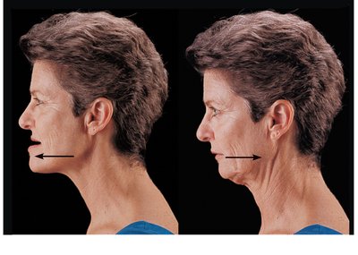 Protraction and retraction of the mandible