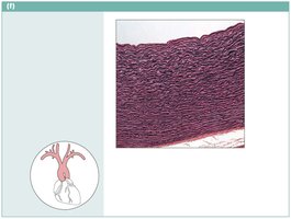 Elastic connective tissue photomicrograph