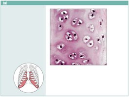 Hyaline cartilage photomicrograph