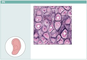 Elastic cartilage photomicrograph