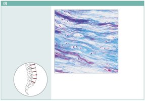 Fibrocartilage photomicrograph