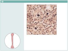 Bone tissue photomicrograph
