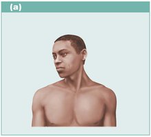 Cutaneous membrane (skin)