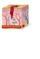 Tissue repair: inflammation stage