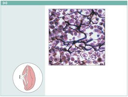 Reticular connective tissue photomicrograph