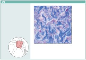 Dense irregular connective tissue photomicrograph