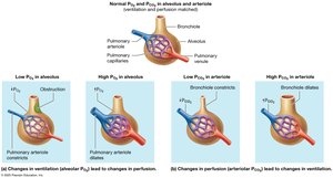 Ventilation-perfusion matching