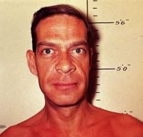 Dwarfism, gigantism, and acromegaly