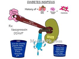Diabetes insipidus cartoon