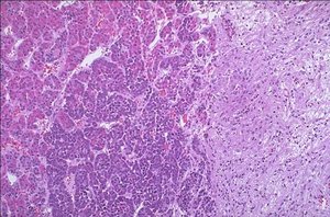 Histology of anterior and posterior pituitary