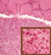 Parathyroid gland histology