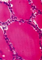 Thyroid and parathyroid gland histology zoom