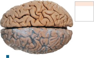 Superior view of cerebrum and cerebellum