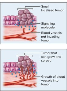 Angiogenesis in tumor growth