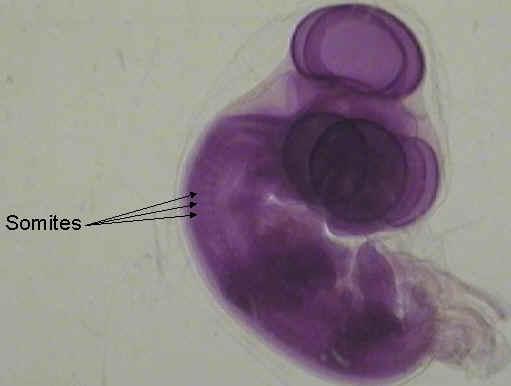Somites in a developing embryo