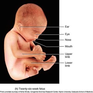 Twenty-six-week fetus
