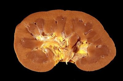 Cross section of adult kidney showing cortex and medulla