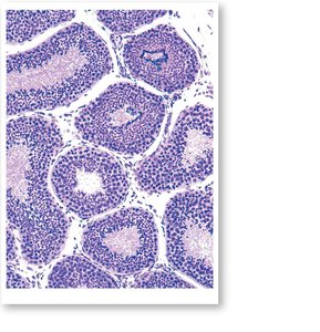Histological section of seminiferous tubules in the testis