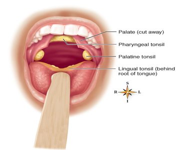 Location of tonsils in the mouth and throat