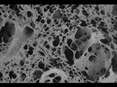 Electron micrograph of alveolar network