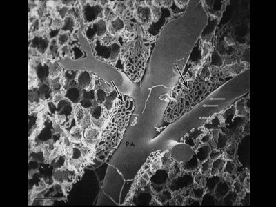 Electron micrograph of alveolar structure and pulmonary artery