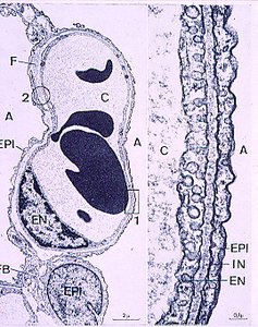 Ultrastructure of alveolar wall showing epithelial and endothelial layers