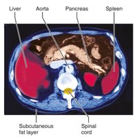 Transverse MRI scan