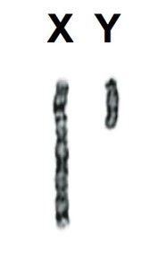 XY chromosome pair