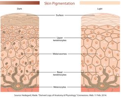 Diagram comparing dark and light skin pigmentation