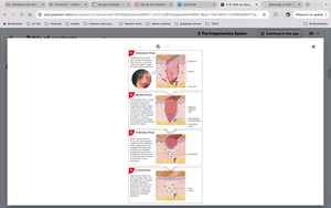 Stages of skin wound healing