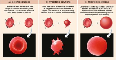 Effects of isotonic, hypertonic, and hypotonic solutions on red blood cells