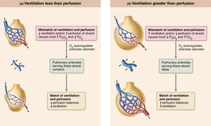 Ventilation-perfusion coupling