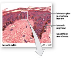 Micrograph showing melanocytes in the stratum basale