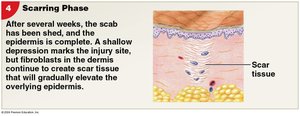 Scarring phase of skin repair