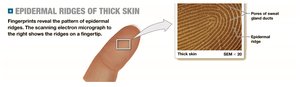 Epidermal ridges of thick skin, showing fingerprint pattern
