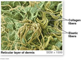 SEM of reticular layer of dermis showing collagen and elastic fibers
