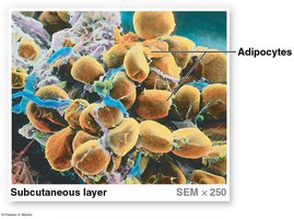SEM of subcutaneous layer showing adipocytes