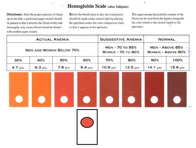 Abnormal Hints Anatomy & Physiology Circulatory System Study Guide | Notes
