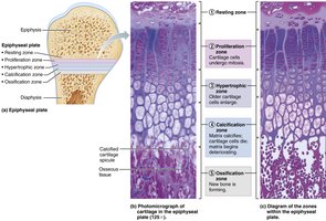 Growth in length of a long bone at the epiphyseal plate
