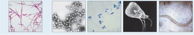 Microscopic images of bacteria, viruses, fungi, protozoans, and worms