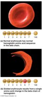 Normal and sickle-shaped erythrocytes with hemoglobin sequence