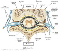 Sectional view of spinal cord and meninges