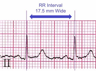 Anatomy & Physiology Heart Conduction Study Guide | Notes