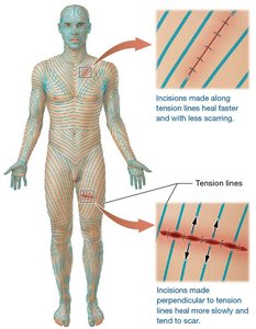 Tension lines on the human body