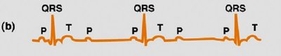 Abnormal ECG: partial AV block